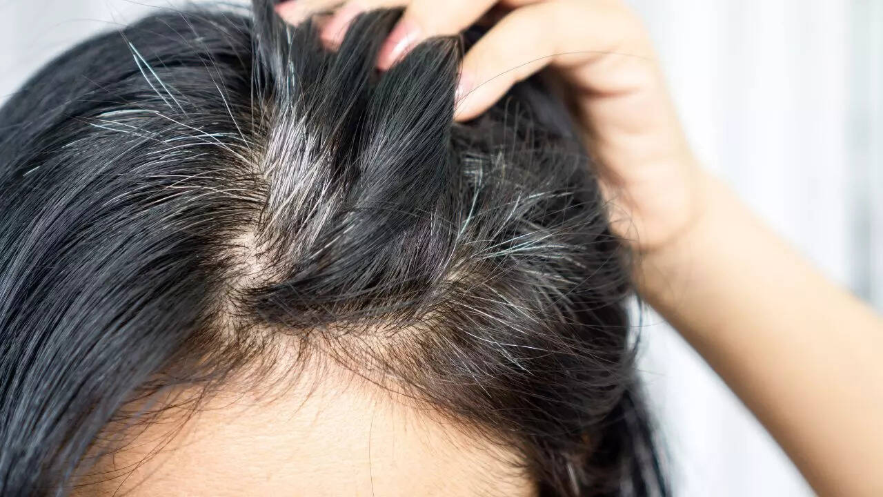 Why gray hair happens and how cocoa powder supports hair health